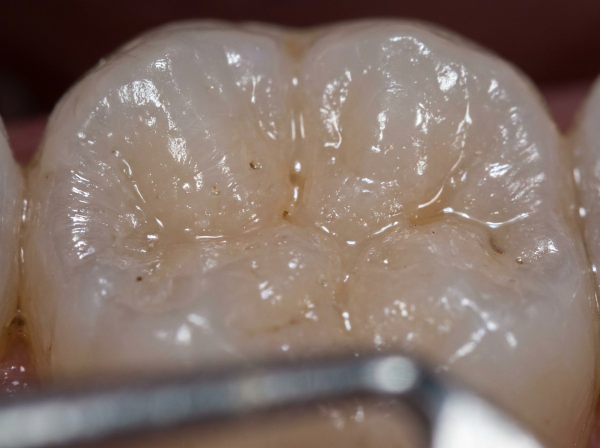 Extreme macro photograph of a human tooth surface showing natural enamel texture