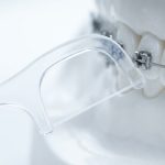 Orthodontic floss pick with a thin flat arm slipped under the archwire of metal braces on a dental teeth model