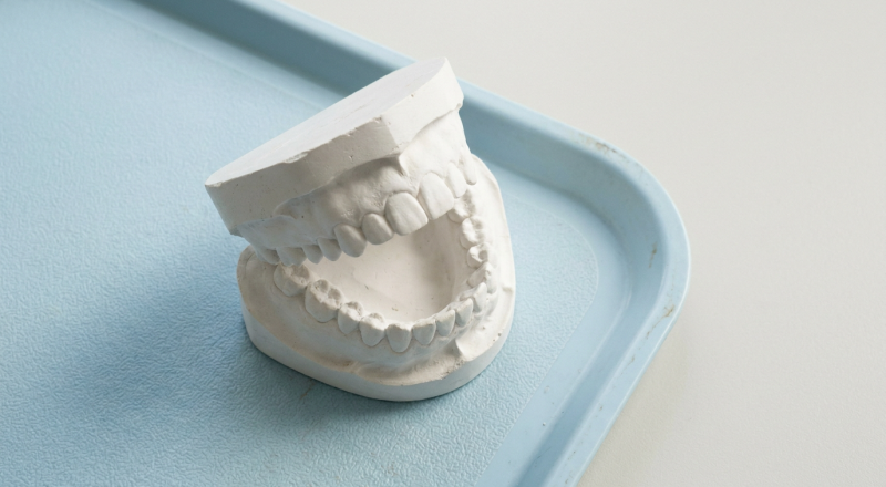 teeth numbers chart reference: plaster dental model of upper and lower adult teeth on a clinic tray